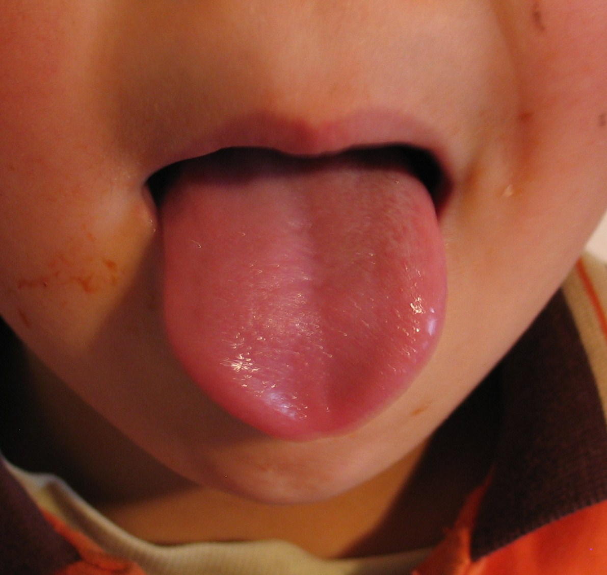 What is your tongue telling you about your health? - Eat Well Enjoy